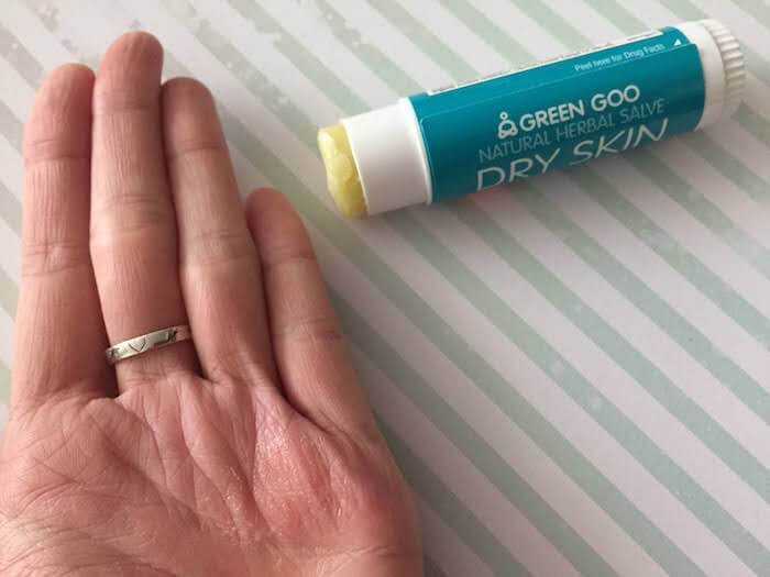 Green Goo Dry Skin Salve for Eczema review hand eczema treatment